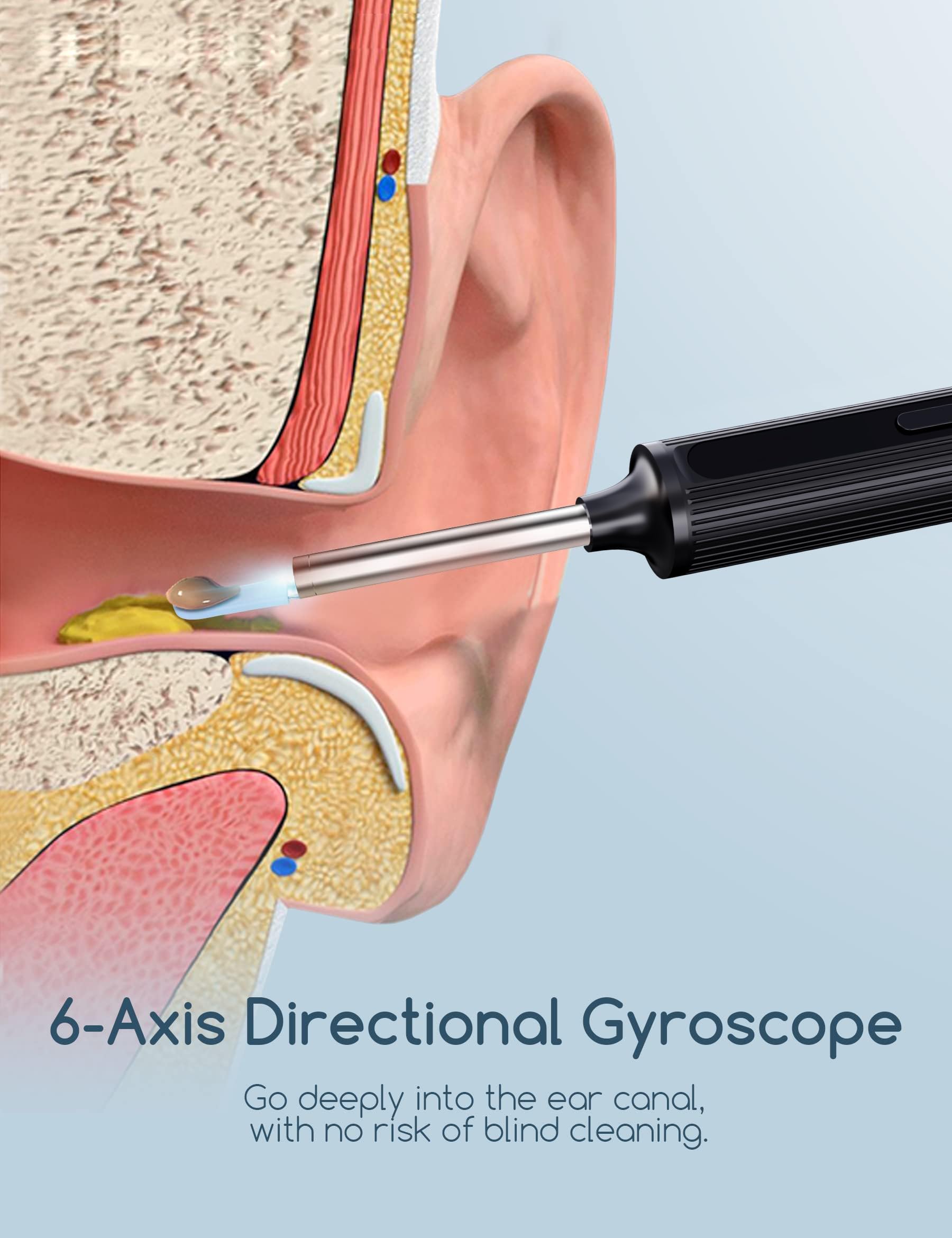 Ohrenschmalz-Entfernungs-Otoskop, WiFi Ohrreiniger, 1080P Ultra Thin HD Wireless wasserdichter Ohrspiegel mit 3,5 mm Objektiv und 6 LEDs für iPhone, iPad und Android Smartphones