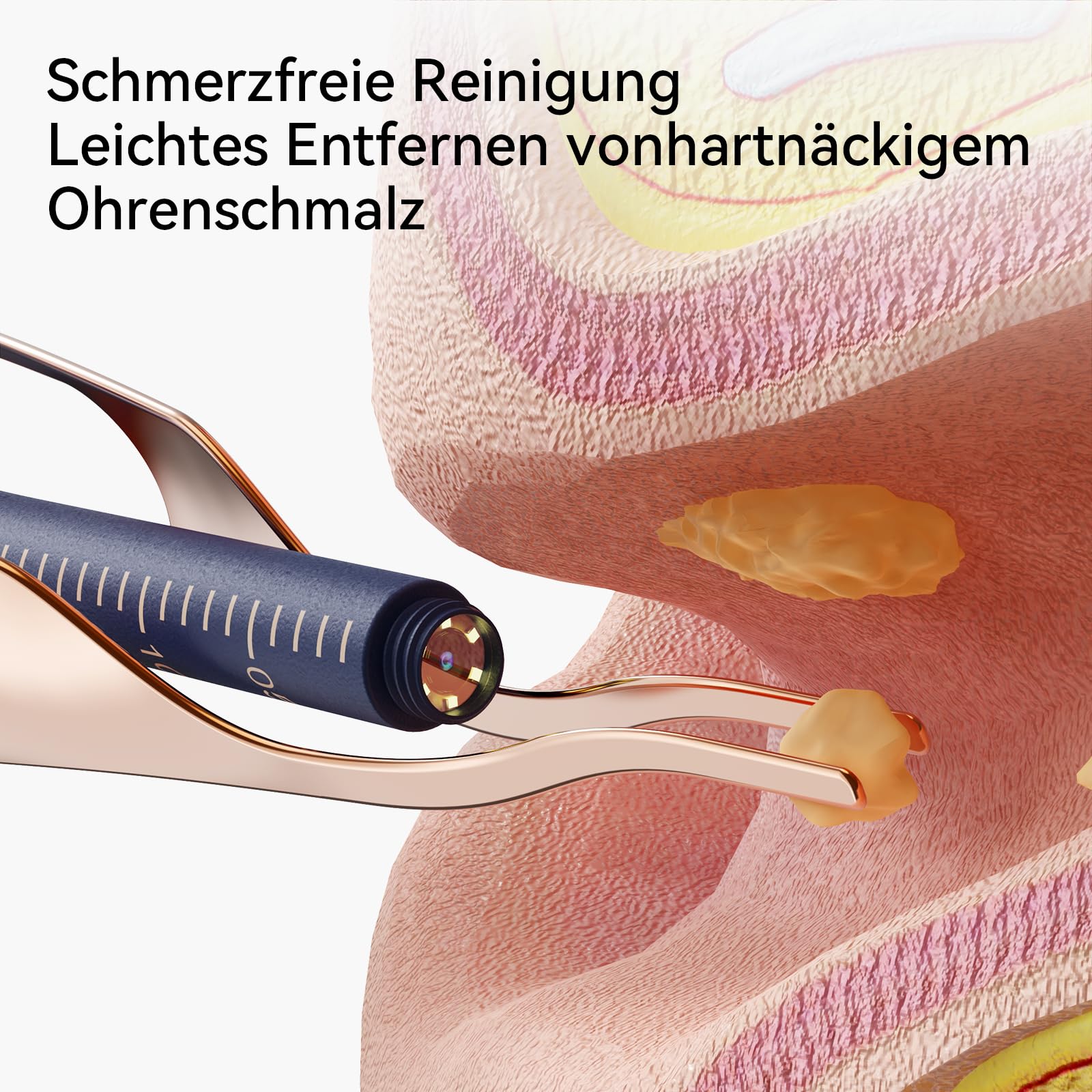 Ohrenschmalz-Entfernungs-Otoskop, WiFi Ohrreiniger, 1080P Ultra Thin HD Wireless wasserdichter Ohrspiegel mit 3,5 mm Objektiv und 6 LEDs für iPhone, iPad und Android Smartphones
