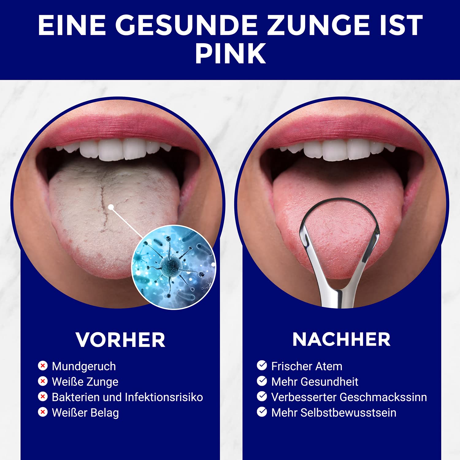 Zungenschaber Edelstahl | Dreier-Pack | Zungenreiniger | Für einen frischen Atem und eine bessere Mundgesundheit | Zungenreiniger Edelstahl | Zungenreiniger für Kinder und Erwachsene | ORAVIX